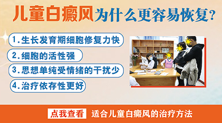 孩子白癜风身上白癜风容易治吗