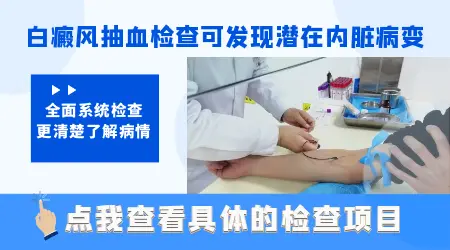 皮肤有白斑需要做什么检查