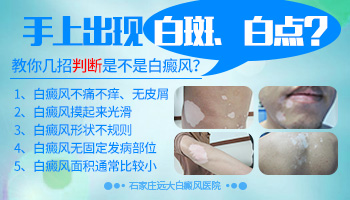 手上不太明显的白斑是什么 怎么治
