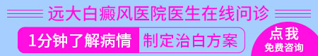 邢台白癜风治疗ZUI好方法