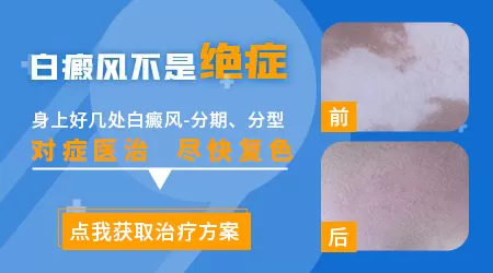 河北石家庄远大中医皮肤病医院怎么样