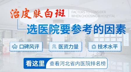 白癜风去石家庄哪里治疗更靠谱