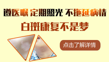 打新冠疫苗会让白癜风加重吗