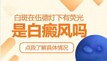 伍德灯检查皮肤乳白色边界清楚代表什么