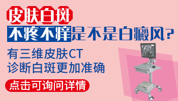 伍德灯和皮肤镜不能确定白癜风吗