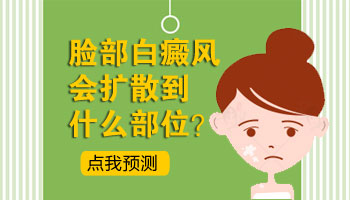家长盲目给孩子照光治疗白癜风可能导致扩散