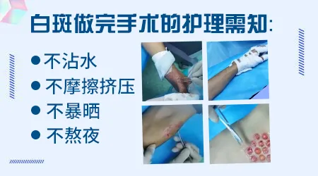 白癜风做植皮手术能不能恢复正常皮肤肤色