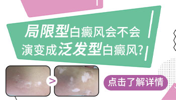 小孩肚子上有白色斑点没有扩大