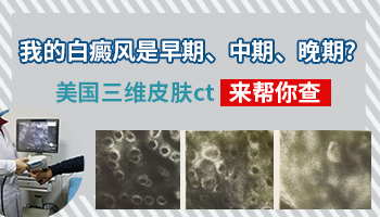 普通白斑和白癜风在伍德灯下的对比