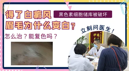 白斑长在眉毛上眉毛变白了能恢复吗