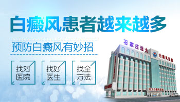 激光照白癜风会不会越照越白