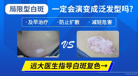 白癜风全变白的样子图片