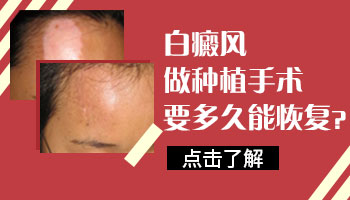 高考完白癜风做种植手术多久能好