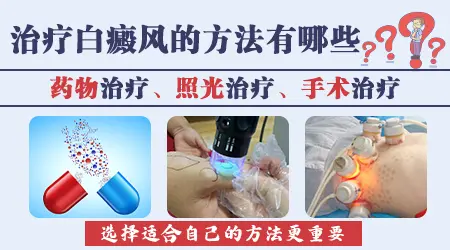 治疗白癜风的特效药有哪些