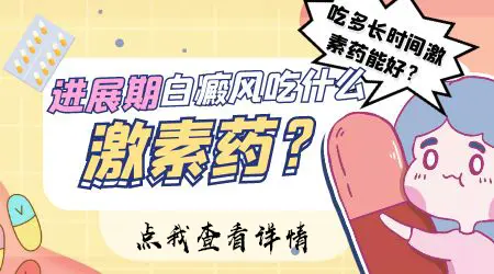 白癜风进展期适合用激素治疗吗