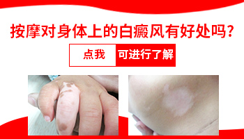 耳朵上的穴位对治疗白癜风有作用吗