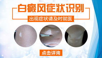 小孩身上有白点图片