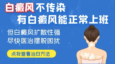 白斑病是怎样传染的