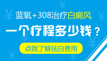 石家庄哪家白癜风医院有蓝氧