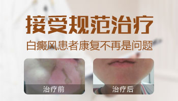 宝宝身上的白点增大怎么控制