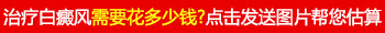 白癜风如何治疗