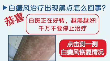 白斑中间出现小黑点说明什么情况