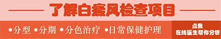 伍德灯下可见亮蓝白色斑片边界清晰