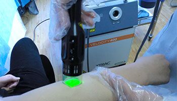 白癜风治疗多长时间才能显效