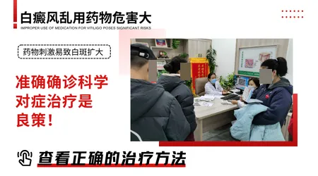 芦可替尼乳膏治疗白癜风的效果如何
