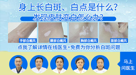 全身都有白色斑点怎么办 白点是什么