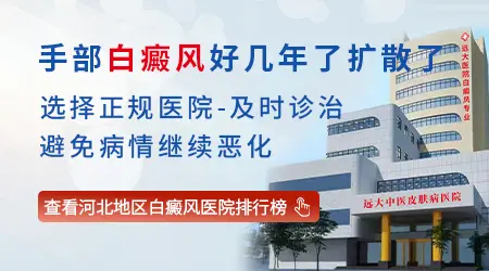 手部白癜风好几年了扩散了