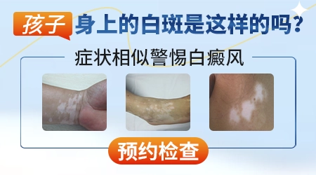 小孩嘴角的皮肤突然的变得比较白是什么原因
