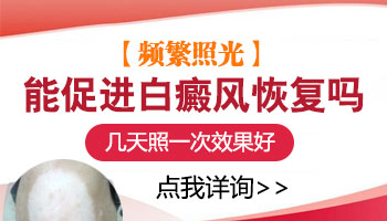 308激光治疗白癜风需要照几次就好了