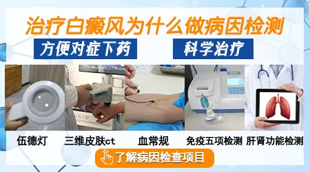 白癜风需要做什么检查能查出病因