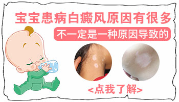 五个多月宝宝白癜风是什么引起的