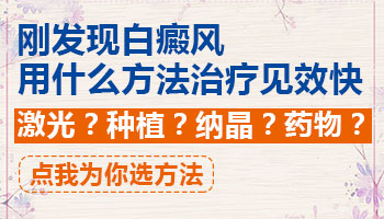 刚出现没多久的白癜风如何治疗