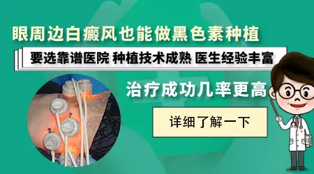 眼周边白癜风能否做黑色素种植