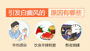 邢台白癜风的患病原因怎么确定呢
