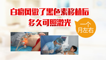 白癜风做完表皮移植后多久可以光疗