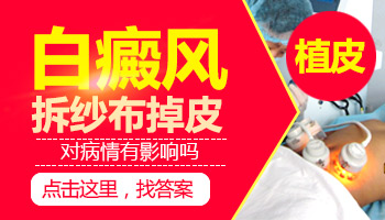 白癜风植皮会掉吗
