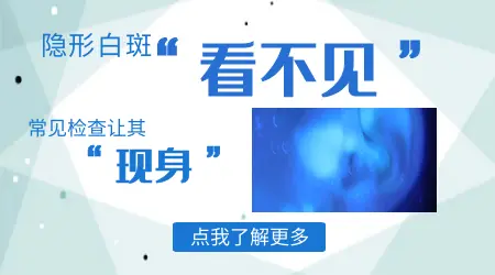 儿童白癜风图片早期时候的