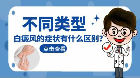 各种白癜风的症状和区别