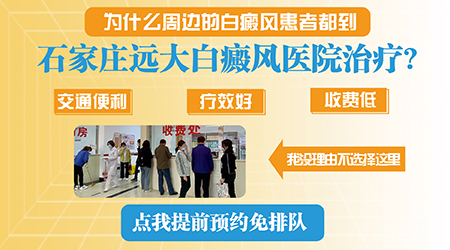 河北白斑病治疗中心