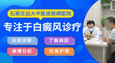 石家庄中医治疗白癜风效果好的医院