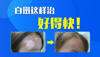 没有特效药 治好白癜风的秘诀原来是这样