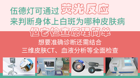 伍德灯检查白斑有稍亮白荧光