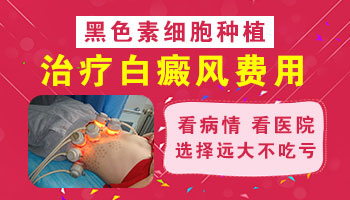 白癜风做种植后输几天液 大概费用是多少