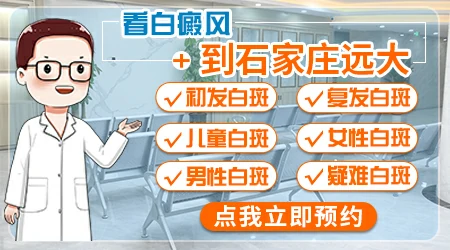 石家庄哪个医院能治反复复发的白斑
