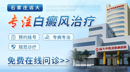 石家庄正规白癜风专科医院排名