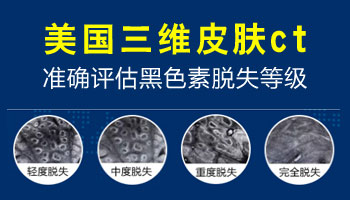 白癜风在皮肤CT下的表现 